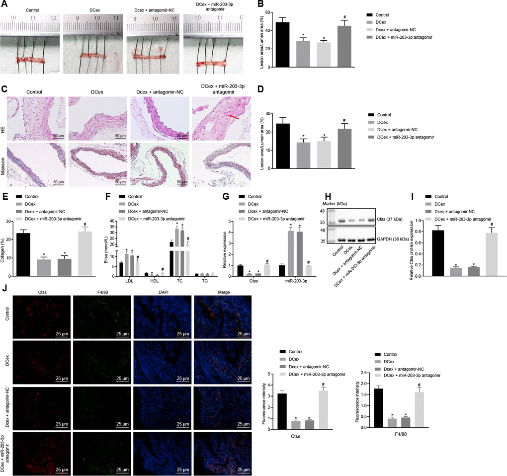 DCex and miR-203-3p contribute to alleviate AS in vivo. The HFD-fed ApoE-/- mice did not receive any treatment as controls, or were treated with DCex alone, DCex + antagomir-NC, or miR-203-3p antagomir (n = 8 for each group). (A, B) Oil red O staining for atherosclerotic plaque in ApoE-/- mice. (C–E) HE staining (200 ×) and Masson staining (200 ×) for atherosclerotic plaque in ApoE-/- mice (In panel C, red arrows show plaque location). (F) Serum LDL, HDL, TC, and TG levels in ApoE-/- mice determined by ELISA. (G) miR-203-3p expression and mRNA expression of Ctss in vascular tissues in ApoE-/- mice evaluated by RT-qPCR. (H, I) The protein expression of Ctss in vascular tissues in ApoE-/- mice evaluated by Western blot analysis. (J) Immunofluorescent double staining for the expression of F4/80 and Ctss (400 ×). *p vs. mice without treatment; #p vs. mice treated with DCex. Statistical data were measurement data, and described as mean ± standard deviation. The one-way analysis of variance was adopted for comparisons among multiple groups, followed by Tukey’s post hoc test. The experiment was repeated 3 times independently.