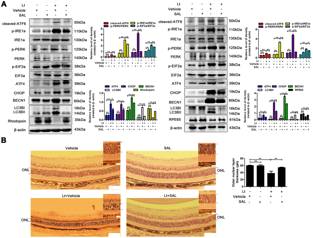 Suppressing ER stress inhibits prolonged autophagy and protects the retina against light injury. The mice were intraperitoneally injected with a dose of 1 mg/kg once a day for 7 days. On the third day of administration, the mice were exposed to continuous 7000 Lux visible light for 12 h. After light exposure, the mice were fed in the animal room with the normal light/dark cycle. On the fifth day of light exposure, the mice were sacrificed, and the eyeballs were enucleated. (A) The retinas were collected, and target proteins were determined with western blotting. β-actin was referenced as an internal control. Three independent experiments are conducted three weeks apart. The results are presented as the mean± SEM. n (per group) =3, NS: no significance, *P B) The retinas were sectioned and stained with H&E and photographed under a microscope. Scale bar=100 μm; 20 μm. The thickness of the outer nuclear layer (ONL) was measured and quantitatively analyzed. The results are presented as the mean± SEM, n (per group) =6, NS: no significance, **P 