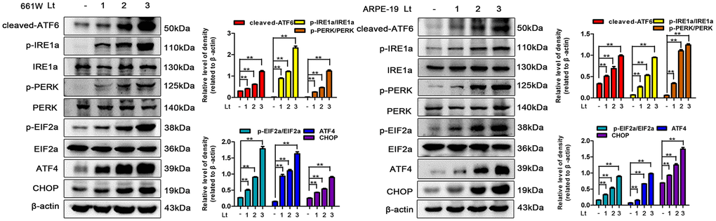 Light exposure induces ER stress in photoreceptors and RPEs. 661W cells and ARPE-19 cells were cultured in a dark condition or exposed to 1500 Lux light for 1–3 days after which the levels of ER stress markers were determined by western blotting. β-actin was referenced as an internal control. Three independent experiments are conducted two weeks apart. The results are presented as the mean± SEM. n (per group) =3, **P 