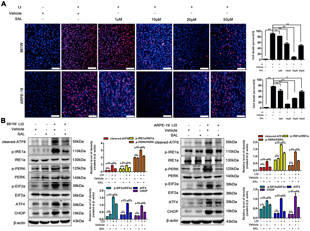 SAL treatment suppresses light-induced ER stress and protects photoreceptors and RPEs. (A) 661W cells/RPE cells were treated with SAL (1 μM, 10 μM, 20 μM and 50 μM) and cultured under 1500 Lux light or dark conditions for the indicated times. The percentage of cell death was evaluated with PI/Hoechst staining. Scale bar=100 μm. (B) The cells were treated with SAL (20 μM for 661W cells; 10 μM for ARPE-19 cells) or vehicle and cultured under light/dark conditions for 3 days, after which the levels of ER stress markers in the whole cell lysate were determined with western blotting, and β-actin was referenced as an internal control. Three independent experiments are conducted two weeks apart. The results are presented as the mean± SEM. n (per group) =3, NS: no significance, *P 