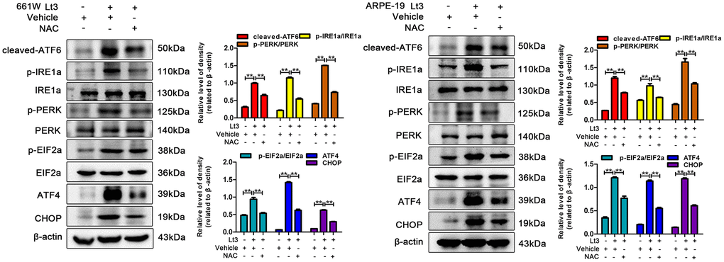 NAC treatment suppresses light-induced ER stress in photoreceptors and RPEs. The cells were treated with NAC (5 mM for 661W cells; 2.5 mM for ARPE-19 cells) or vehicle and cultured under light/dark conditions for 3 days, the levels of ER stress markers were determined with western blotting, and β-actin was referenced as an internal control. Three independent experiments are conducted two weeks apart. The results are presented as the mean± SEM. n (per group) =3, **P 