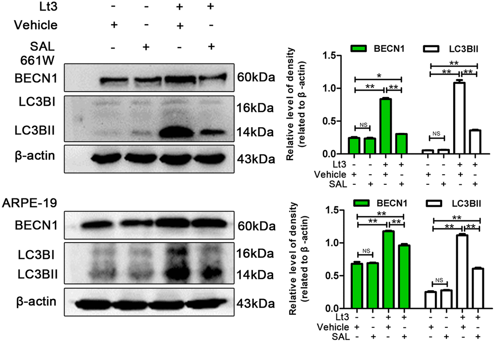 Inhibiting ER stress suppresses light-related autophagy. 661W cells/ARPE-19 cells were treated with SAL (20 μM for 661W cells; 10 μM for ARPE-19 cells) or vehicle and cultured under light/dark conditions for 3 days. The level of BECN1 and LC3BII in the whole cell lysate were determined with western blotting, and β-actin was referenced as an internal control. Three independent experiments are conducted two weeks apart. The results are presented as the mean± SEM. n (per group) =3, NS: no significance, *P 