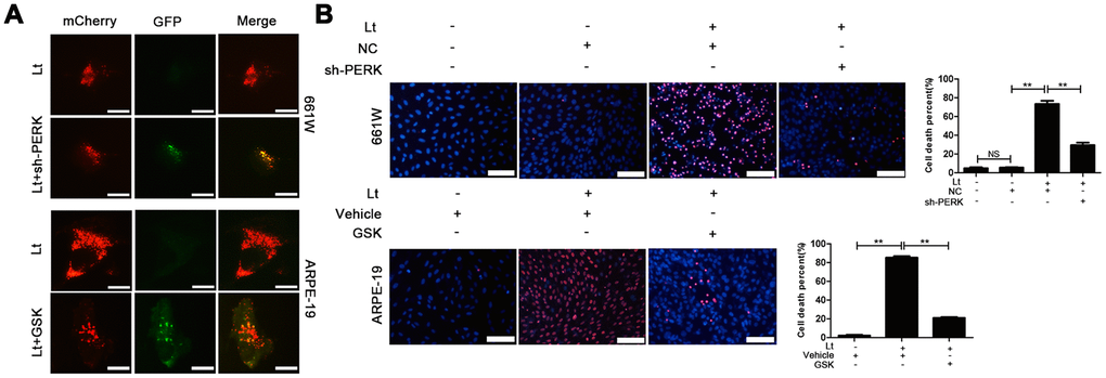 Inhibiting PERK blocks autophagic flow and protects the light-damaged cells. (A) 661W cells with stable PERK knockdown and ARPE-19 cells were infected with mCherry-GFP double labeled-LC3B mediated by adenovirus. At 48 h after infection, the ARPE-19 cells were treated with GSK (5 μM) or vehicle. The cells were cultured under 1500 Lux light condition for 3 days and photographed under fluorescence microscopy. Scale bar=20 μm. (B) 661W cells with PERK knockdown were cultured under light/dark conditions for 3 days, but ARPE-19 cells treated with GSK (5 μM) or vehicle were cultured under light/dark conditions for 6 days. The percentage of cell death was evaluated with PI/Hoechst staining. Scale bar=100 μm. Three independent experiments are conducted two weeks apart. The results are presented as the mean± SEM. n (per group) =3, NS: no significance, **P 