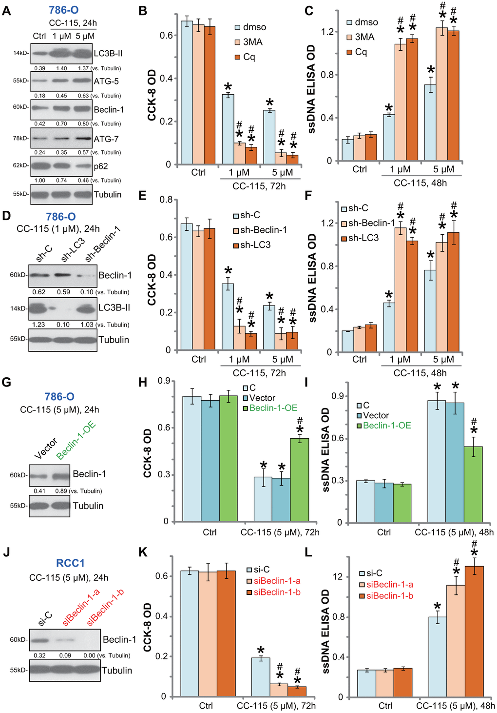 Autophagy inhibition sensitizes CC-115 in RCC cells. 786-O cells were treated with CC-115 (5 μM) for 24h, expression of listed proteins in total cell lysates were shown (A); 786-O cells were pre-treated with 3-methyladenine (3-MA, 1 mM), chloroquine (Cq, 5 μM) or 0.5% DMSO vehicle control (“dmso”) for 1h, followed by CC-115 (5 μM) treatment for indicated time periods, cell viability and apoptosis were tested by CCK-8 assay (B) and ssDNA ELISA assay (C), respectively. Stable 786-O cells with Beclin-1 shRNA (“sh-Beclin1”), LC3 shRNA (“sh-LC3”) or scramble control shRNA (“sh-C”), were treated with CC-115 (1/5 μM) for indicated time periods, expression of listed proteins (D), cell viability (E) and apoptosis (F) were tested. Vector control or the “Beclin-1-OE” 786-O cells were treated with/without CC-115 (5 μM) for applied time; Listed proteins were tested (G); Cell viability (H) and apoptosis (I) were tested similarly. Primary human RCC cells (“RCC-1”), transfected with Beclin-1 siRNA-a (“siBeclin1-a”, Santa Cruz Biotech), Beclin-1 siRNA-b (“siBeclin1-b”, Cellular Signaling Tech) or scramble control siRNA (“siCtrl”) (200 nM each), were treated with/without CC-115 (5 μM) for applied time; Listed proteins were tested by Western blot assay (J); Cell viability (K) and apoptosis (L) were tested. “C” stands for parental control cells (H, I). Expression of listed proteins were quantified and normalized to the loading control (A, D, G, J). *P #P B, C). #P E, F, K, L). #P H, I).