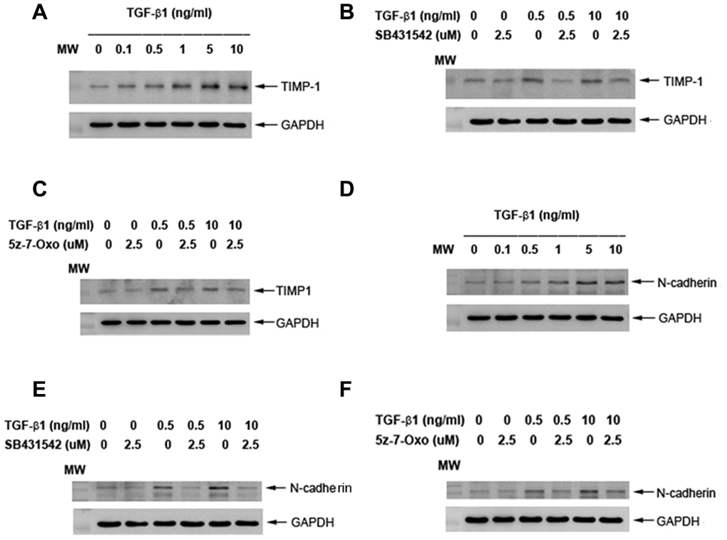 Effect of TGF-β1 on TIMP-1 and N-cadherin protein expression of cultured SHED. (A) TIMP-1 protein expression of SHED after exposure to TGF-β1 for 24 hours. (B) Effect of SB431542 on the TGF-β1-induced TIMP-1 expression of SHED. (C) Effect of 5z-7oxozeaenol on the TGF-β1-induced TIMP-1 expression of SHED. (D) N-cadherin protein expression of SHED after exposure to TGF-β1 for 24 hours. (E) Effect of SB431542 on the TGF-β1-induced N-cadherin expression of SHED. (F) Effect of 5z-7oxozeaenol on the TGF-β1-induced N-cadherin expression of SHED. One representative western blot picture was shown.