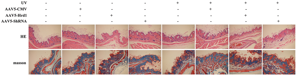 The effect of Hrd1 transfection on the histopathological alteration in UV-induced nude mice by HE staining and Masson’s trichrome staining.