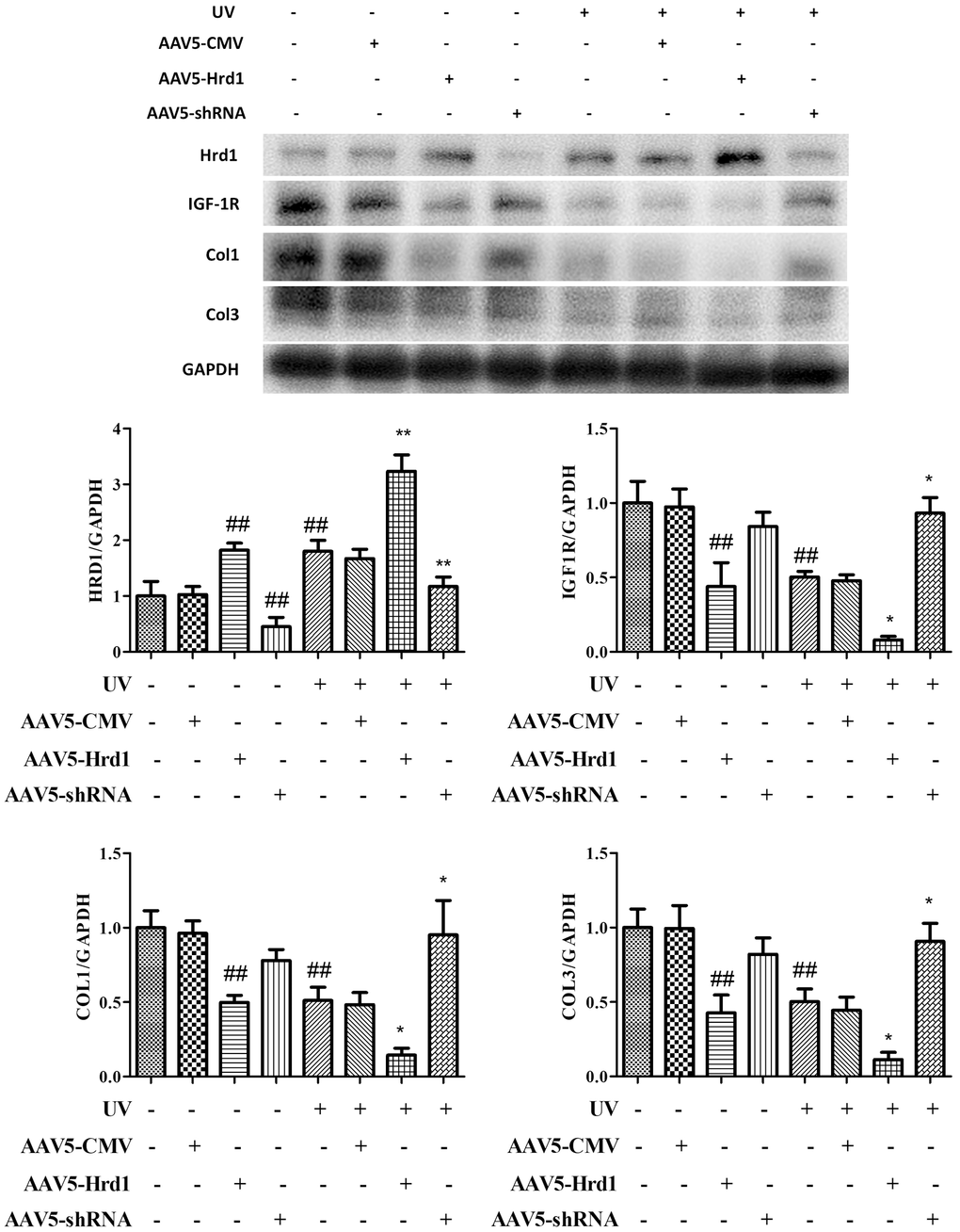 The effect of Hrd1 transfection on protein expressions of Hrd1, IGF-1R, Type I collagen and Type III collagen by western blot in mice. The results were presented as mean ± SD. ##