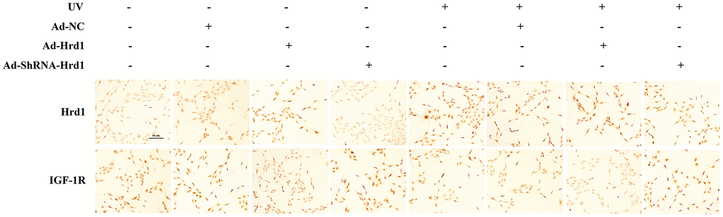 The effect of Hrd1 transfection on the protein expressions of Hrd1 and IGF-1R by immunohistochemistry in HSF cells.