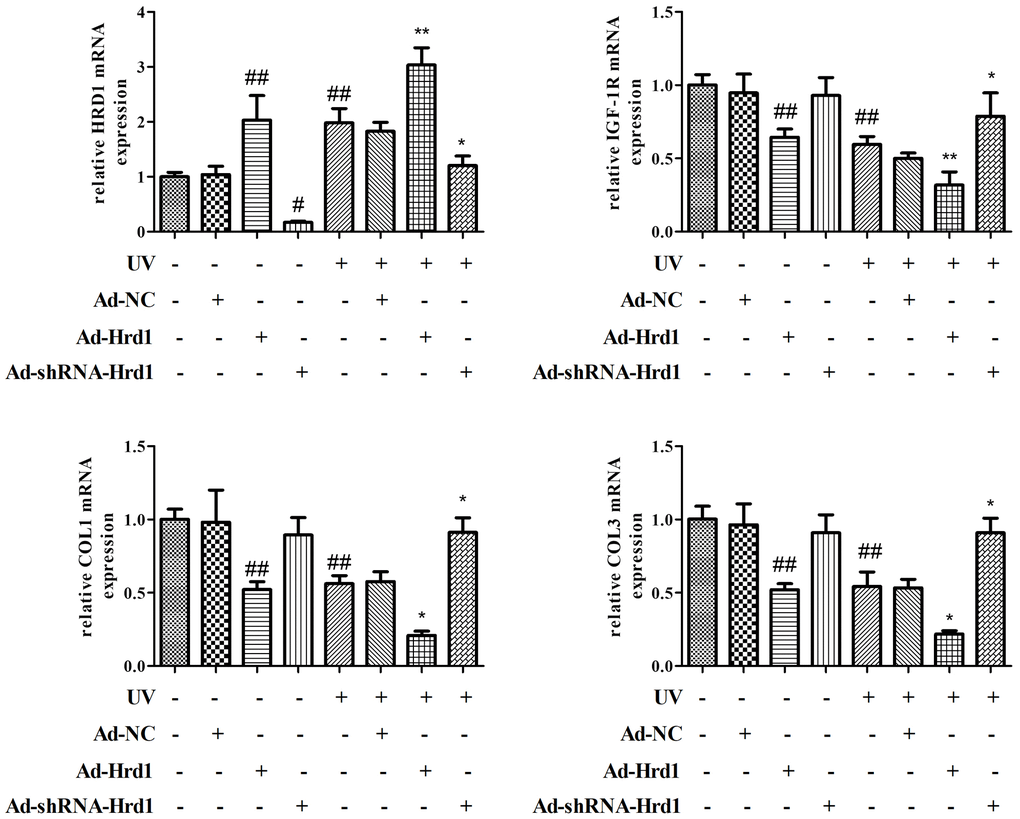 The effect of Hrd1 transfection on the mRNA expressions of Hrd1, IGF-1R, Type I collagen and Type III collagen in HSF cells. The results were presented as mean ± SD. ##