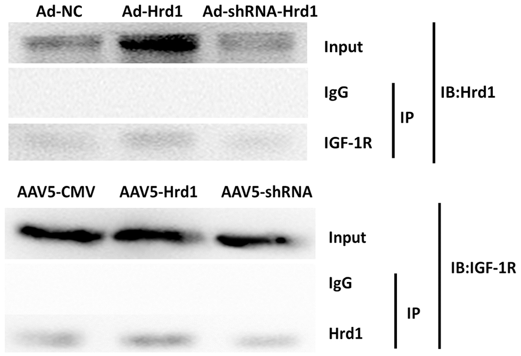 The effect of Hrd1 transfection on Co-IP.