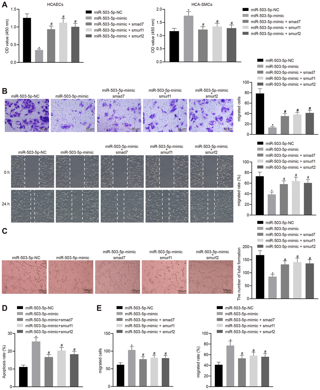 Overexpression of Smad7, smurf1, and smurf2 abrogates the effects of miR-503-5p on HCAECs and HCASMCs. HCAECs and HCASMCs were treated with exogenous miR-503-5p mimic (with miR-mimic NC as control) and expression vectors containing smad7, smurf1, or smurf2 gene. (A) Proliferation of HCAECs and HCASMCs detected by CCK-8 assay. (B) Migration of HCAECs detected by transwell migration assays and scratch test (×200). (C) Vessel-like tube-forming ability in HCAECs detected by Matrigel-based angiogenesis assays (×100). (D) Apoptosis of HCAECs detected by flow cytometry. (E) Migration of HCASMCs detected by transwell migration assays and scratch test (×200). Values obtained from three independent experiments in triplicate were analyzed by one-way ANOVA followed by Tukey's post hoc test among three or more groups. * p p 