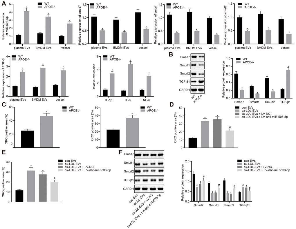 Depletion of miR-503-5p inhibits the formation of atherosclerotic plaques in vivo. (A) Expression of miR-503-5p (normalized to U6), and TGF-β1, smad7, smurf1, and smurf2 (normalized to GAPDH) in plasma-EVs, macrophage-EVs, and arterial tissues of ApoE-/- mice (n = 3) and WT mice (n = 3) determined by RT-qPCR. (B) Protein levels of TGF-β1, smad7, smurf1, and smurf2 (normalized to GAPDH) in plasma-EVs, macrophage-EVs, and arterial tissues of ApoE-/- mice (n = 3) and WT mice (n = 3) determined by Western blot analysis. (C) Lipid deposition in mouse arterial tissues detected by Oil red O staining; Scale bar = 50 μm. (D) EVs derived from macrophages with or without ox-LDL treatment were separately injected into the tail vein of C57BL6 WT mice at dose of 100 μg for each. One week later, EVsinjected mice were injected with lentivirus expressing anti-miR-503-5p and anti-miR-503-5p NC. (E) The lipid plaque of arterial tissues of C57BL/6J WT mice (n = 12) detected by Oil red O staining. (F) Expression of smad7, smurf1, and smurf2 (normalized to GAPDH) in arterial tissues of C57BL/6J WT mice (n = 12) determined by Western blot analysis. Values obtained from three independent experiments in triplicate were analyzed by unpaired t test between two groups and by one-way ANOVA followed by Tukey's post hoc test among three or more groups. * p 