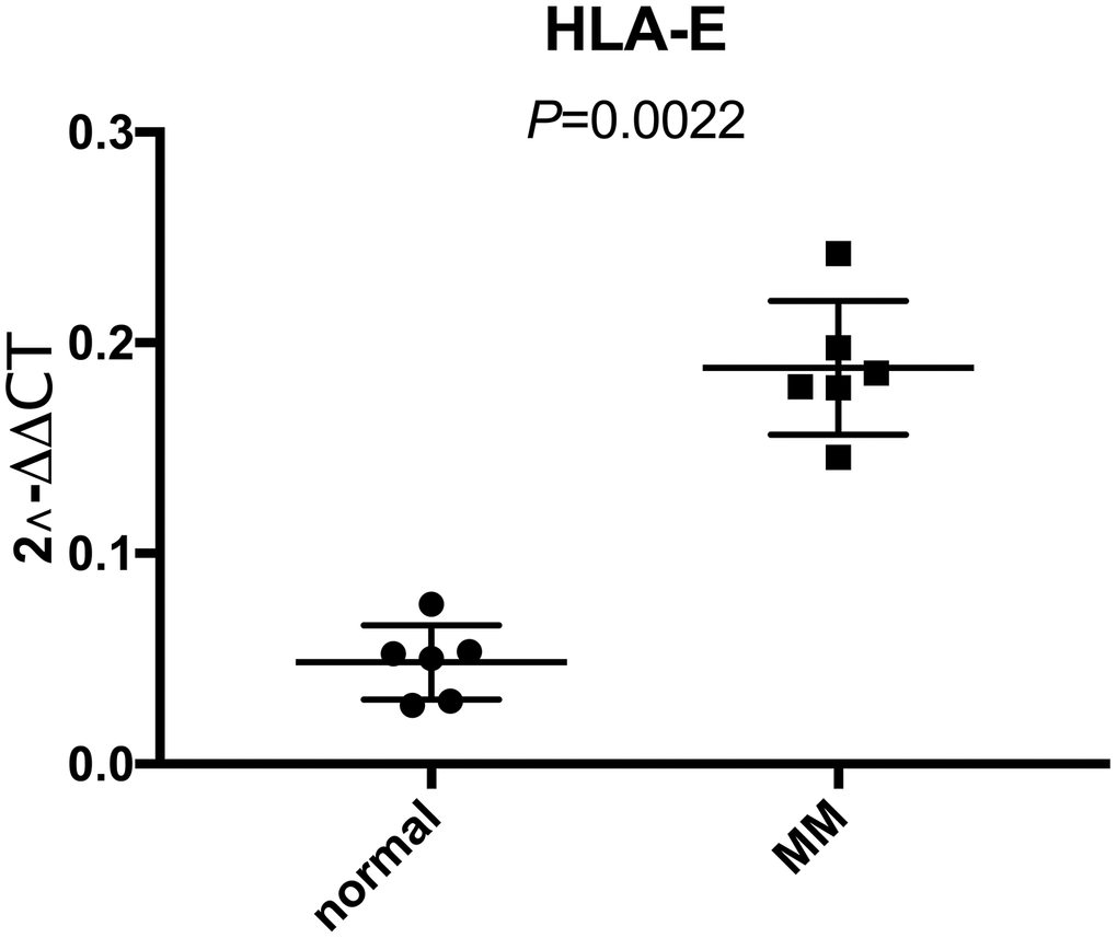 Higher expression of HLA-E mRNA in CD138 positive myeloma cells than normal plasma cells detected with real-time qPCR. The expression of HLA-E mRNA in normal plasma cells and MM cells were 0.048 ± 0.018 and 0.188 ± 0.032, respectively (P 