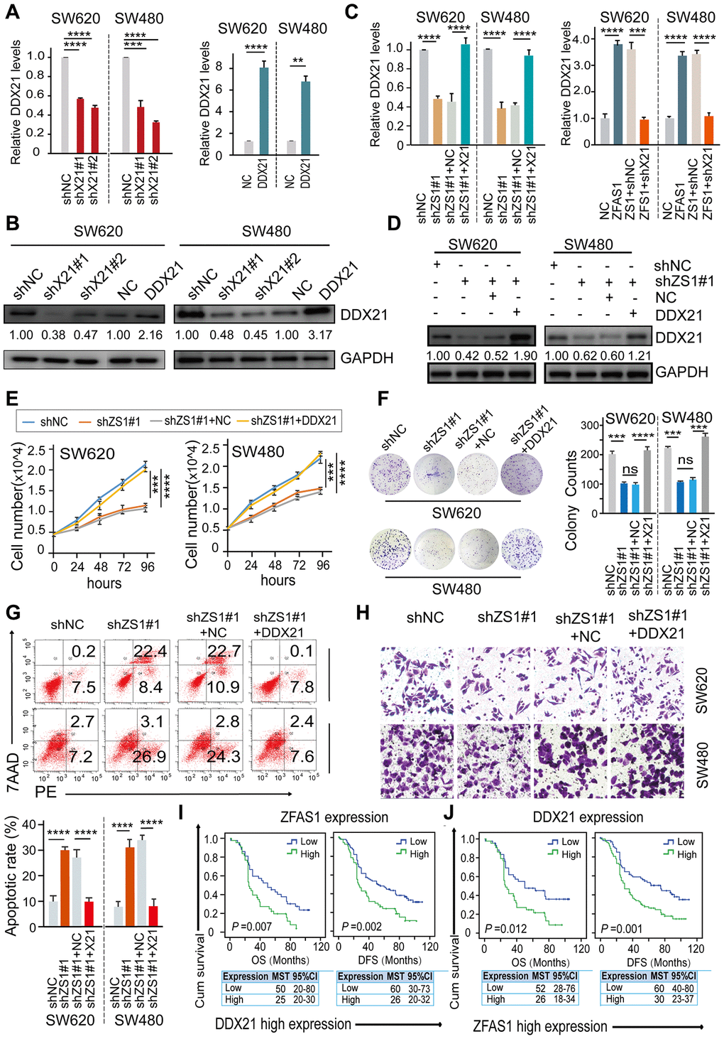 DDX21 rescued the CRC cells proliferation inhibition caused by ZFAS1 knockdown. (A and B) The expression of DDX21 after silencing or overexpression DDX21 in SW620 and SW480 cells by qPCR (A) and western blot (B). (C and D) Rescue experiments detecting the DDX21 mRNA and protein expression levels treated by co-transfection of lncRNA ZFAS1 silencing and DDX21 overexpression vectors or ZFAS1 overexpression with DDX21 silencing vectors in SW620 and SW480 cells assayed by qPCR assay (C) and western blot assay (D). (E–H) The cell proliferation, colony formation, invasion ability, and cellular apoptotic rates were recovered after co-transfected with shRNA ZFAS1 and pcDH-DDX21 vector in SW620 and SW480 cells assayed by cell number monitoring assay (E), cell colony formation assay (F), flow cytometry method (G), trans-well (H) respectively. (I and J) Stratified Kaplan-Meier plot illustrating the impact of ZFAS1 high/low expression on the DFS and OS upon those patients with DDX21 high expression (I), DDX21 high/low expression on the prognosis based on the patients with lncRNA ZFAS1 high expression (J). Data were shown as mean ± s.d.. n = 3 independent experiments. Two-tailed Student’s t-tests were used. *P P P P 