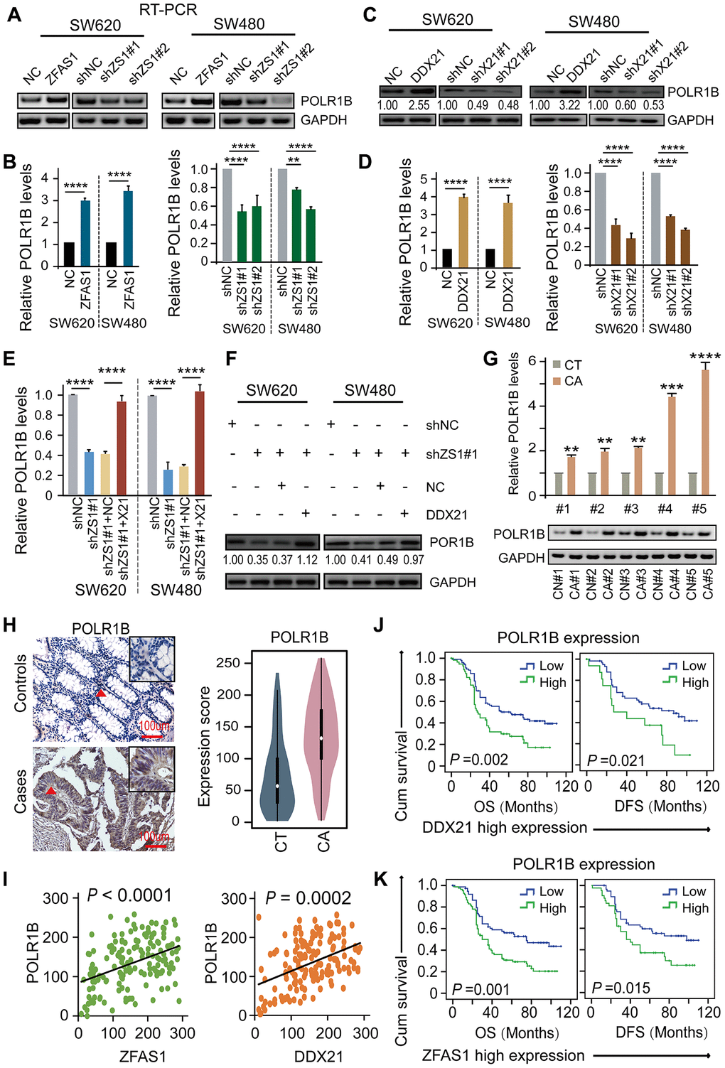 DDX21-PLOR1B signaling axis regulated by lncRNA ZFAS1 in CRC cells and tissues. (A and B) The mRNA expression of POLR1B after overexpression or silencing lncRNA ZFAS1 in SW620 and SW480 cells by RT-PCR (A) and qPCR assay (B). (C and D) The expression levels of POLR1B after interfering DDX21 expression in both SW620 and SW480 cells detected by western blot (C) and qPCR assay (D). (E and F) Rescue experiments determining the POLR1B mRNA and protein expression levels treated by silencing of lncRNA ZFAS1 and overexpression of DDX21 in SW620 and SW480 cells assayed by qPCR assay (E) and western blot assay (F). (G) Representative analysis results of POLR1B expression in paired CRC tissues and controls assayed by RT-PCR and qPCR method. 5 representative data was shown. (H) Representative IHC imagines and Violin charts displaying the POLR1B protein expression based on the CRC patient tissues and matched tumor-adjacent controls (n = 157). The bar represents 100μm. (I) Linear regression analysis illustrating a positive correlation between the expression of POLR1B and LncRNA ZFAS1 or DDX21. (J and K) Stratified Kaplan-Meier plot illustrating the impact of POLR1B high/low expression on the DFS and OS upon those patients with DDX21 high expression (J) or with ZFAS1 high expression (K). Data were shown as mean ± s.d. Two-tailed Student’s t-tests were used. *P P P P 