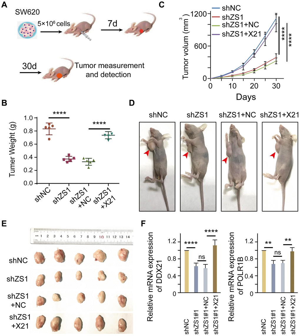 DDX21 promoting cell proliferation regulated by LncRNA-ZFAS1 in vivo. (A) Schematic diagram of xenografts in BALB/c nude mice by inoculating SW620 cells that were stably co-transfected with shZFAS1, shZFAS1+ pcDH-DDX21, shNC (empty-vector), and shZFAS1+NC at their right armpits. (B) Mean xenografts tumor weight for each group was determined on the 30th day. Data are shown as mean ± s.d., n = 5 for each group. (C) Mean tumor volumes on different days for each group xenografts in nude mice. (D and E) Representative xenograft mice and tumors excised on the 30th day are shown. (F) qPCR assays were performed to determine the mRNA expression of DDX21 and POLR1B above each group. The groups were as follows: shNC (empty vector); shZS1 (shZFAS1#1); shZS1+NC (co-transfected with shRNA and pcDH empty vector); shZS1+X21 (co-transfected with shZFAS1 and pcDH-DDX21).*, P P P P 