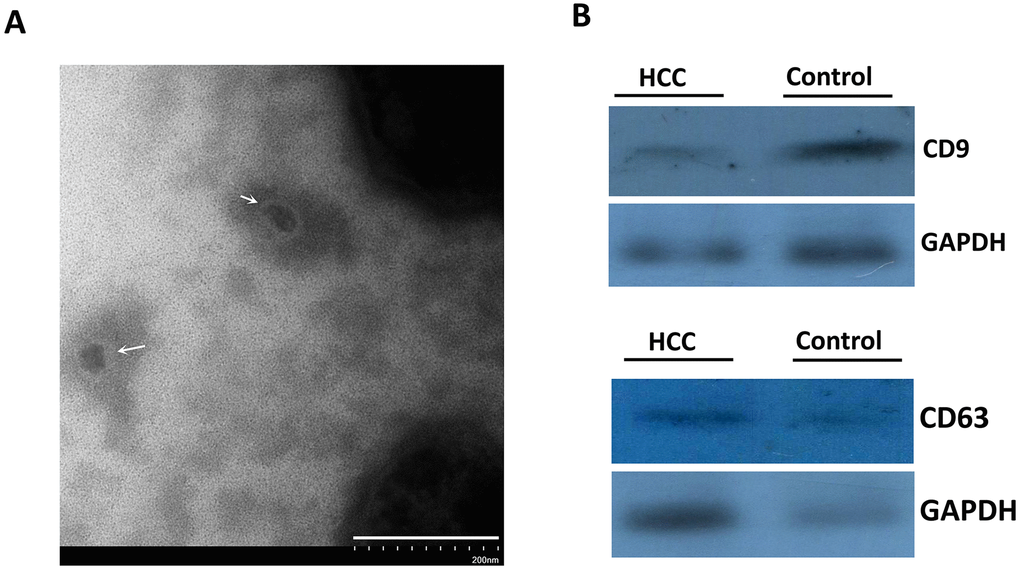 The identification of isolated vesicles in the serum using TEM and immunoblotting. (A) The morphology of serum exosomes under TEM. The white arrows indicated the isolated vesicles. (B) CD9 and CD63 proteins representing exosome markers were detected using western blot.