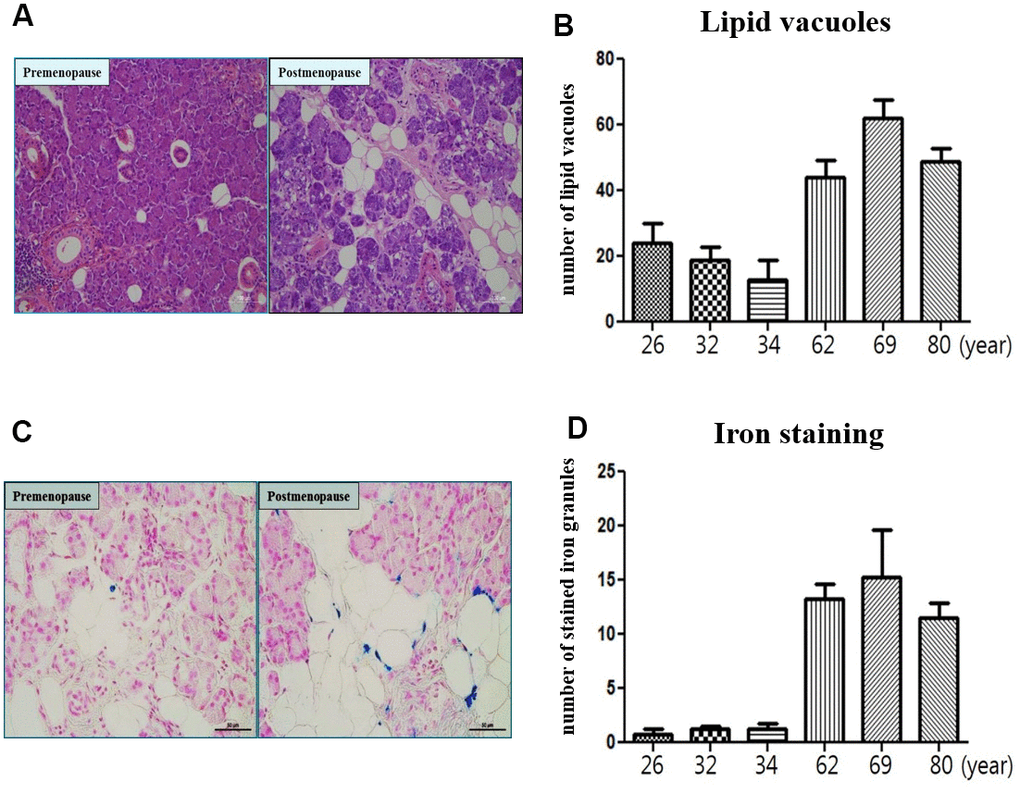 Microscopic finding of human submandibular gland tissue. (A) Lipid vacuoles of submandibular gland detected by H & E staining in the postmenopause group than premenopause group. (B) The number of lipid vacuoles of submandibular gland in the postmenopause group than premenopause group. (C) Iron accumulation of submandibular gland detected by Prussian Blue iron staining in the postmenopause group than premenopause group. (D) The number of stained iron of submandibular gland in the postmenopause group than premenopause group.