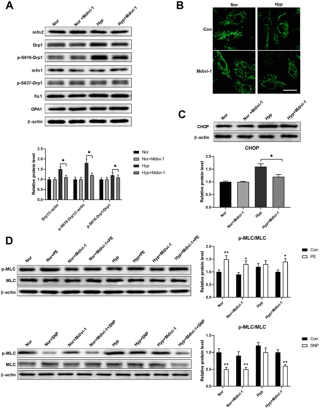 Mitochondrial fragmentation enhanced ER stress in cultured PASMCs under hypoxia. (A) Mdivi-1 treatment decreased Drp1 and Drp1 phosphorylation at serine 616 in PASMCs under hypoxia. Twenty micrograms of protein was loaded for each lane. (B) Mdivi-1 treatment inhibited mitochondrial fragmentation in PASMCs under hypoxia. Scale bar, 20 μm. (C) Mdivi-1 treatment inhibited ER stress as evidenced by the decreased CHOP expression in PASMCs under hypoxia. Twenty micrograms of protein was loaded for each lane. (D) Mdivi-1 treatment improved PASMC function as evidenced by increased PE/SNP-induced MLC phosphorylation/dephosphorylation in PASMCs under hypoxia. Twenty micrograms of protein was loaded for each lane. *, p p 