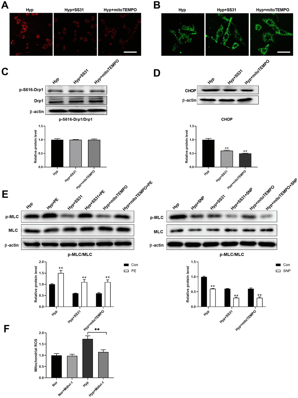 Mitochondrial ROS mediated the interaction between mitochondria and ER. (A) SS31 and mitoTEMPO scavenged mitochondrial ROS as detected by mitoSOX. Scale bar, 100 μm. (B) SS31 and mitoTEMPO inhibited hypoxia-induced mitochondrial fragmentation in PASMCs. Scale bar, 20 μm. (C) SS31 and mitoTEMPO showed little effects on Drp1 expression and Drp1 phosphorylation at serine 616 in PASMCs under hypoxia. Twenty micrograms of protein was loaded in each lane. (D) SS31 and mitoTEMPO decreased CHOP expression in PASMCs under hypoxia. Twenty micrograms of protein was loaded in each lane. (E) SS31 and mitoTEMPO improved PASMC function as evidenced by increased PE/SNP-induced MLC phosphorylation/dephosphorylation in PASMCs under hypoxia. Twenty micrograms of protein was loaded in each lane. (F) Inhibition of mitochondrial fragmentation using Mdivi-1 decreased mitochondrial ROS in PASMCs in hypoxia. *, p p 