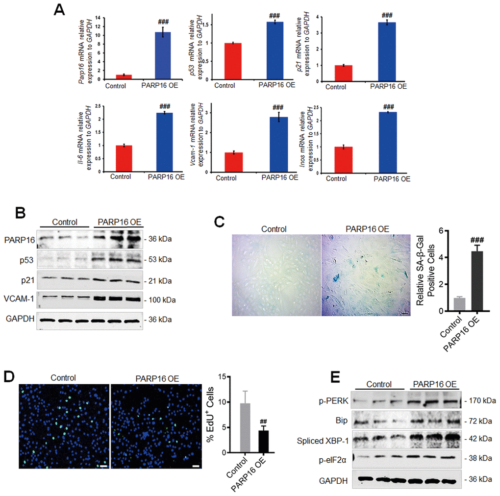 PARP16 overexpression promotes RAECs senescence and endoplasmic reticulum. RAECs were transfected with lentivirus-mediated PARP16 cDNA (PARP16 OE) for 72 h, Parp16, p21, p53, Il-6, Vcam-1, Inos mRNA level were confirmed by qRT-PCR. Data shown are representative of data from at least three different replicates; ###p vs. control. (A); cell lysates were immunoblotted with antibody against PARP16, p53, p21 and VCAM-1. GAPDH serves as internal control (B); SA-β-Gal staining (C) and EdU incorporation assay (D) of RAECs upon overexpression of PARP16, ##p ###p vs. control, n=5; (E) p-PERK, p-eIF2α, Bip and Spliced XBP-1 level were determined in PARP16 overexpressing cells. Data shown are representative of data from at least three different replicates.