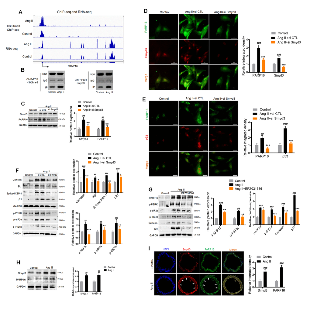 Binding of Smyd3 to both promotors of Parp16 transcript variants leads to increased H3K4me3 level and elevated gene expression. (A) Integrative Genomics Viewer (IGV) showed signal of ChIP-seq (H3K4me3) and RNA-seq at PARP16 coding gene’s locus in control and Ang II-induced (Ang II, 48 h) RAEC cells. The Y axis was normalized to the same scale. Black arrow means primer pairs used for ChIP-PCR in panel B. (B) ChIP-PCR using either H3K4me3, Smyd3 or IgG antibody was carried out in control and Ang II-induced RAECs. (C–F) Knockdown of Smyd3 inhibited Ang II-induced PARP16 expression and ER stress. PARP16 was assayed by Western blot for RAECs transfected with control or Smyd3 siRNA before and after Ang II treatment. GAPDH serves as loading control (C); Immunofluorescence double staining of Smyd3 and PARP16 in Ang II-induced RAECs (D); Immunofluorescence double staining of p53 and PARP16 in Ang II-induced RAECs (E); ER-associated markers (Calnexin, Bip, Spliced XBP-1, p-PERK, p-eIF2α, p-IRE1α and), together with senescence-associated marker p21 were assayed by Western blot for RAEC cells transfected with control or Smyd3 siRNA before and after Ang II induction (F). (G) Smyd3 inhibitor EPZ031686 reversed Ang II-induced PARP16 and RAECs senescence. PARP16, p-PERK, p-eIF2α, p-IRE1α, Calnexin and p21 were assayed by Western blot for Ang II-induced RAEC cells with or without 20 μM EPZ031686. GAPDH serves as internal control. All data were shown as mean ± S.D of at least 4 independent experiments, ##p ###p vs. control; *p **p ***p vs. Ang II+si CTL or Ang II treated cells. (H–I) Smyd3 and PARP16 expression were increased in arteries from control and Ang II-infused mice model. Smyd3 and PARP16 protein expression were assayed by Western blot for aorta from control and Ang II-infused mice (H); Immunofluorescence double staining of PARP16 and Smyd3 of arteries in control and Ang II-infused mice model, the arrowheads indicate the positive endothelial cells staining in the whole blood vessel (I); Data were shown as mean ± S.D, ##p ###p vs. control, n=6/group.