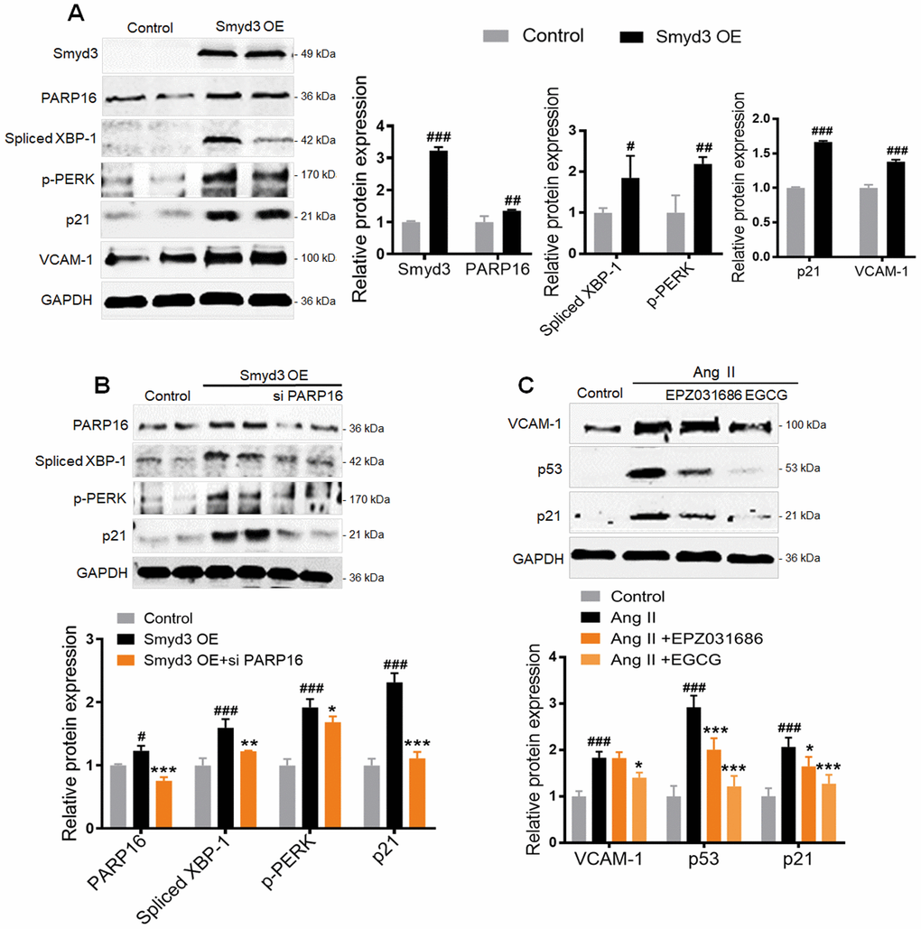 Smyd3 overexpression induces PARP16-mediating ER stress. (A) RAECs were transfected with lentivirus-mediated Smyd3 cDNA (Smyd3 OE) for 72 h, cell lysates were immunoblotted with antibody against Smyd3, PARP16, p21, VCAM-1, p-PERK, Spliced XBP-1. All data were shown as mean ± S.D of at least 4 independent experiments. #p ##p ###p vs. control. (B) Knockdown of PARP16 blocked ER stress and the upregulation of p21 upon overexpression of Smyd3. Smyd3 overexpressed RAECs were transfected with control or Smyd3 siRNA, and then induced by Ang II, cell extracts were collected for determining the protein levels of PARP16, p-PERK, Spliced XBP-1, and p21 by Western blot. Data were shown as mean ± S.D of at least 4 independent experiments. #p ###p vs. control; *p **p ***p vs. Smyd3 OE cells. (C) Inhibition of Smyd3 or PARP16 decreased RAECs senescence markers. Pretreated with PARP16 inhibitor (EGCG) or Smyd3 inhibitor (EPZ031686) for 4 h, RAECs were treated with Ang II for 48 h, respectively, cell extracts were collected for determining the protein levels of p21, p53, and VCAM-1 by Western blot. All data were shown as mean ± S.D of at least 4 independent experiments. ###p vs. control; *p ***p vs. Ang II treated cells.