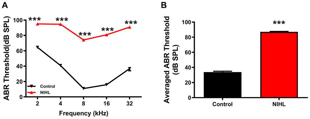 A significant elevation in the ABR threshold was induced by noise exposure in the NIHL group. (A) ABR frequency-threshold curves for the NIHL and control groups. (B) ABR frequency-averaged thresholds for the NIHL and control groups. The values are presented as the mean ± SE of 32 mice per group. *** Ppost hoc comparisons between the NIHL group and the control group using two-way repeated measures ANOVA (A) or t-test (B).