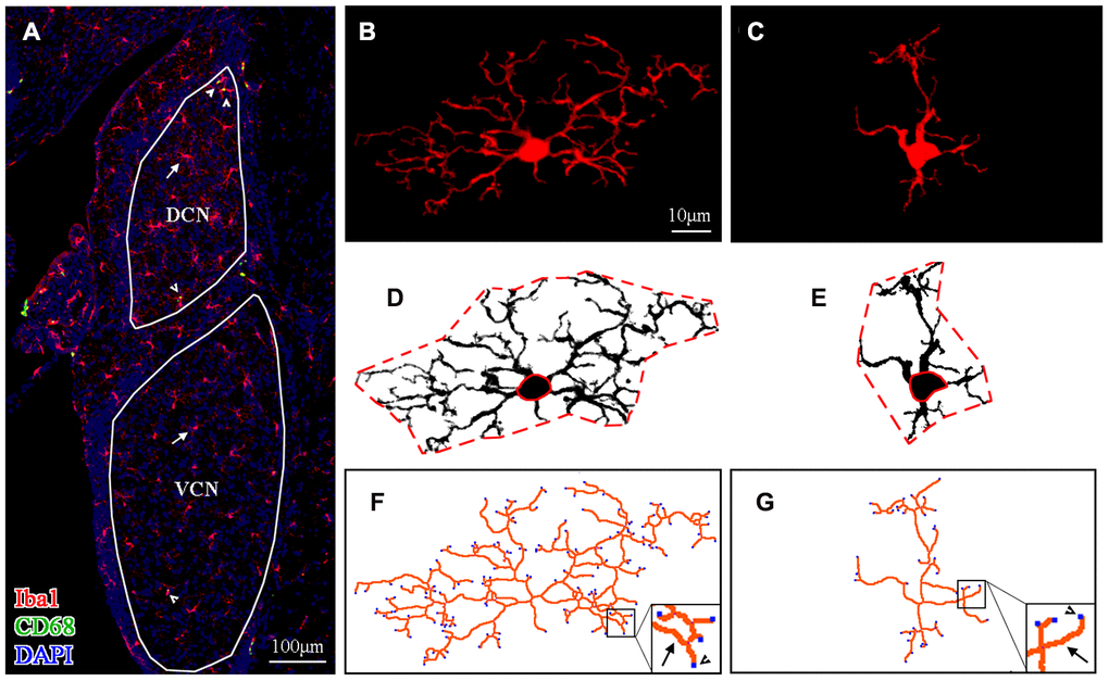 Morphological analysis of microglia. (A) A representative z-projection image of Iba1- and CD68-labeled sections showing the distribution of microglia in the brain region of interest (the VCN and DCN were delineated in this image). The long arrows point to the cells that were Iba1-positive only, and the short arrows point to cells that were both Iba1- and CD68-positive. The scale bar equals 100 μm. (B, C) Representative maximum intensity projections of confocal images of an Iba1-labeled ramified microglial cell (B) and an Iba1-labeled activated microglial cell (C). (D, E) The soma area and the territory area of microglia (in B and C) were delineated by a solid (soma area) red line and a dotted (territory area) red line (in D and E), respectively. (F, G) Maximum intensity projections of confocal images (B and C) were skeletonized. The total process length (orange lines, indicated by arrows in the enlarged insert) and the total number of process endpoints (blue spots, indicated by arrowheads in the enlarged insert) were summarized for statistical comparisons. The scale bar equals 10 μm (B–G).