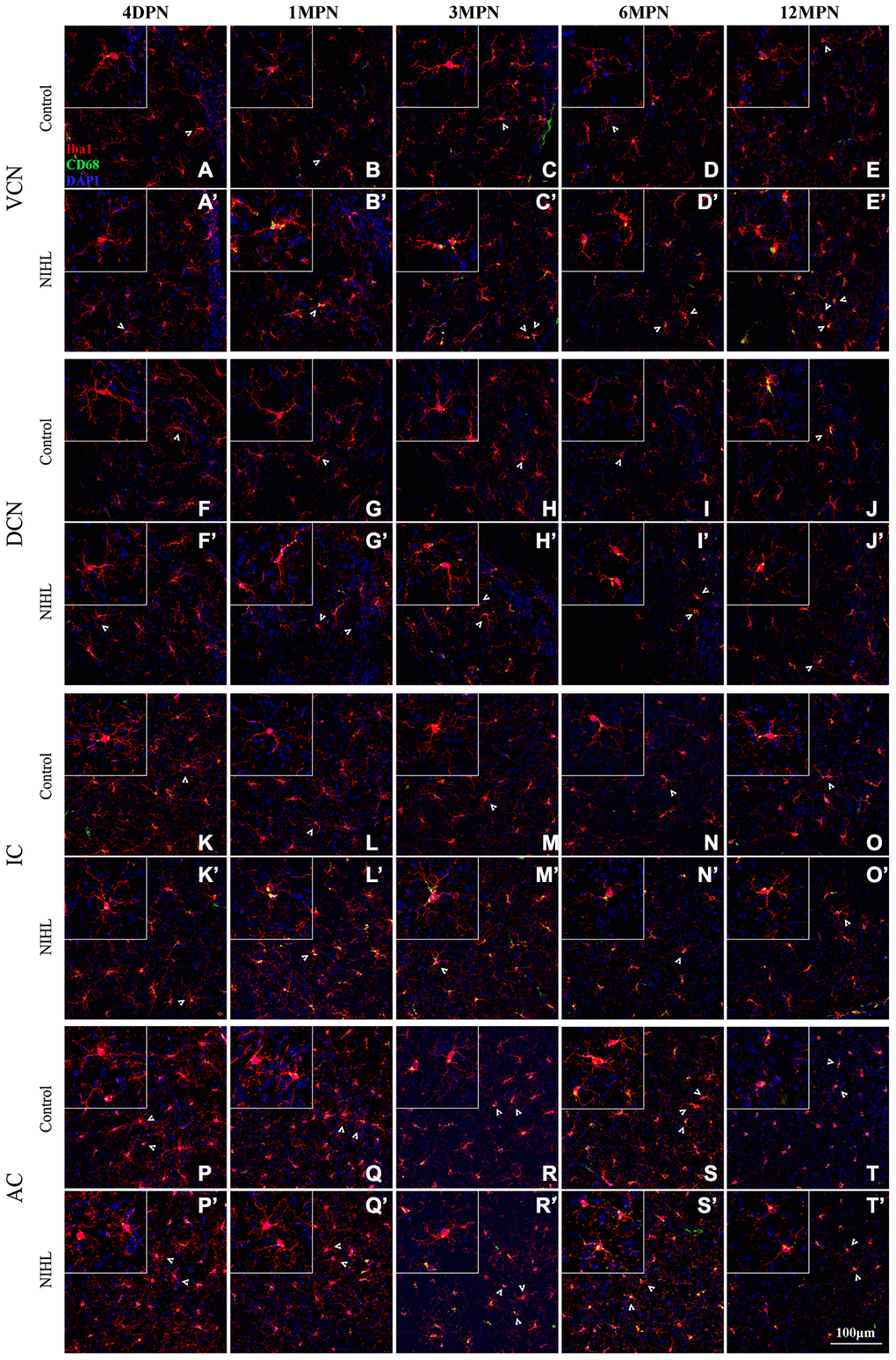 Microglia in the auditory brain regions of NIHL mice assumed an activated morphology. (A–T) Representative z-projection images of Iba1-, CD68-, and DAPI-labeled control brain sections from the VCN (A–E), DCN (F–J), IC (K–O), and AC (P–T). (A’–T’) Representative images of corresponding brain sections from NIHL mice. The insets show higher magnifications of the corresponding Iba1+ cells signified by arrowheads. The scale bar equals 100 μm.