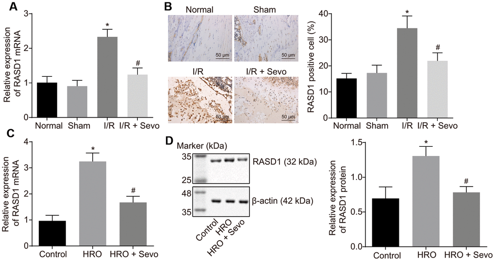 RASD1 is expressed at a high level in I/R injury and Sevoflurane treatment suppresses its expression. (A) The expression pattern of RASD1 following model establishment and Sevoflurane treatment detected using RT-qPCR. (B) Immunohistochemistry analysis of RASD1 expression patterns following model establishment and Sevoflurane treatment (× 200). Normal mice or sham-operated mice: n = 10; I/R mice or I/R mice treated with Sevoflurane: n = 10. (C) RASD1 expression patterns in the skeletal muscle cells after HRO and Sevoflurane treatment detected using RT-qPCR. (D) Western blot analysis of the RASD1 expression patterns in skeletal muscle cells after HRO and Sevoflurane treatment. * p p 