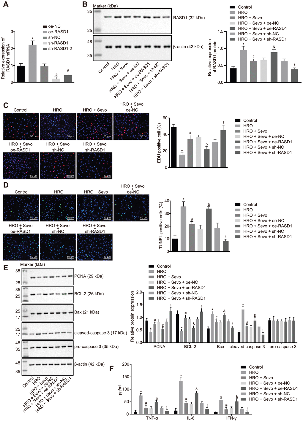 Sevoflurane treatment suppresses RASD1 expression to impede proliferation and stimulate apoptosis in skeletal muscle cells with I/R injury. (A) The expression pattern of RASD1 in cells after alteration of RASD1 detected using RT-qPCR. * p B) Protein level of RASD1 in cells after treatment with HRO, Sevoflurane and RASD1 alteration detected using Western blot analysis. * p p C) Cell proliferation measured using EdU assay (× 200). (D) Cell apoptosis measured by TUNEL assay (× 200). (E) Western blot analysis of the RASD1 expression pattern in cells. (F) Levels of IFN-γ, IL-6 and TNF-α in cells measured by ELISA. * p p p p 