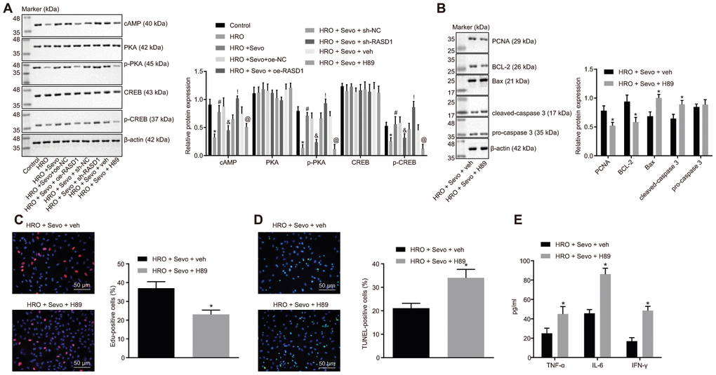 Sevoflurane treatment inhibits apoptosis and promotes proliferation in the skeletal muscle cells with I/R injury by inducing the RASD1-dependent PKA pathway activation. (A) Western blot analysis of cAMP, phosphorylated PKA and phosphorylated CREB levels in cells after treatment with HRO, Sevoflurane and RASD1 alteration/PKA pathway inhibition, * p p p p p B) Western blot analysis of Bcl-2, PCNA, Bax, cleaved caspase-3 and pro-caspase-3 levels in cells after treatment with HRO, Sevoflurane and PKA pathway inhibition. (C) Cell proliferation after treatment with HRO, Sevoflurane and PKA pathway inhibition detected by EdU assay (× 200). (D) Cell apoptosis after treatment with HRO, Sevoflurane and PKA pathway inhibition measured by TUNEL assay (× 200). (E) Levels of IFN-γ, IL-6 and TNF-α in cell culture supernatant after treatment with HRO, Sevoflurane and PKA pathway inhibition measured by ELISA. In panel B-E, * p 