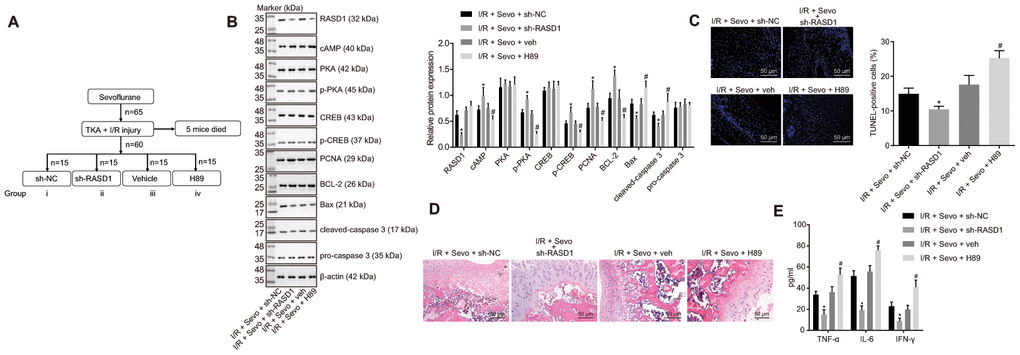 Inhibition of RASD1 facilitates the therapeutic effects of Sevoflurane on I/R injury in mice after TKA by activating the PKA pathway. (A) diagram indicating the different treatment protocols in mice. I/R mice were treated with Sevoflurane + sh-RASD1, Sevoflurane + sh-NC, Sevoflurane + veh and Sevoflurane + H89. (B) Western blot analysis of RASD1, cAMP, PKA, CREB, pro-caspase-3, PCNA, Bcl-2, Bax and cleaved caspase-3 levels and the extents of PKA and CREB phosphorylation in synovial tissues. (C) Cell apoptosis measured by TUNEL assay (× 200). (D) HE staining of the synovial tissues (× 200). (E), Levels of IFN-γ, IL-6 and TNF-α in serum of mice measured by ELISA. * p p t-test. n = 10.