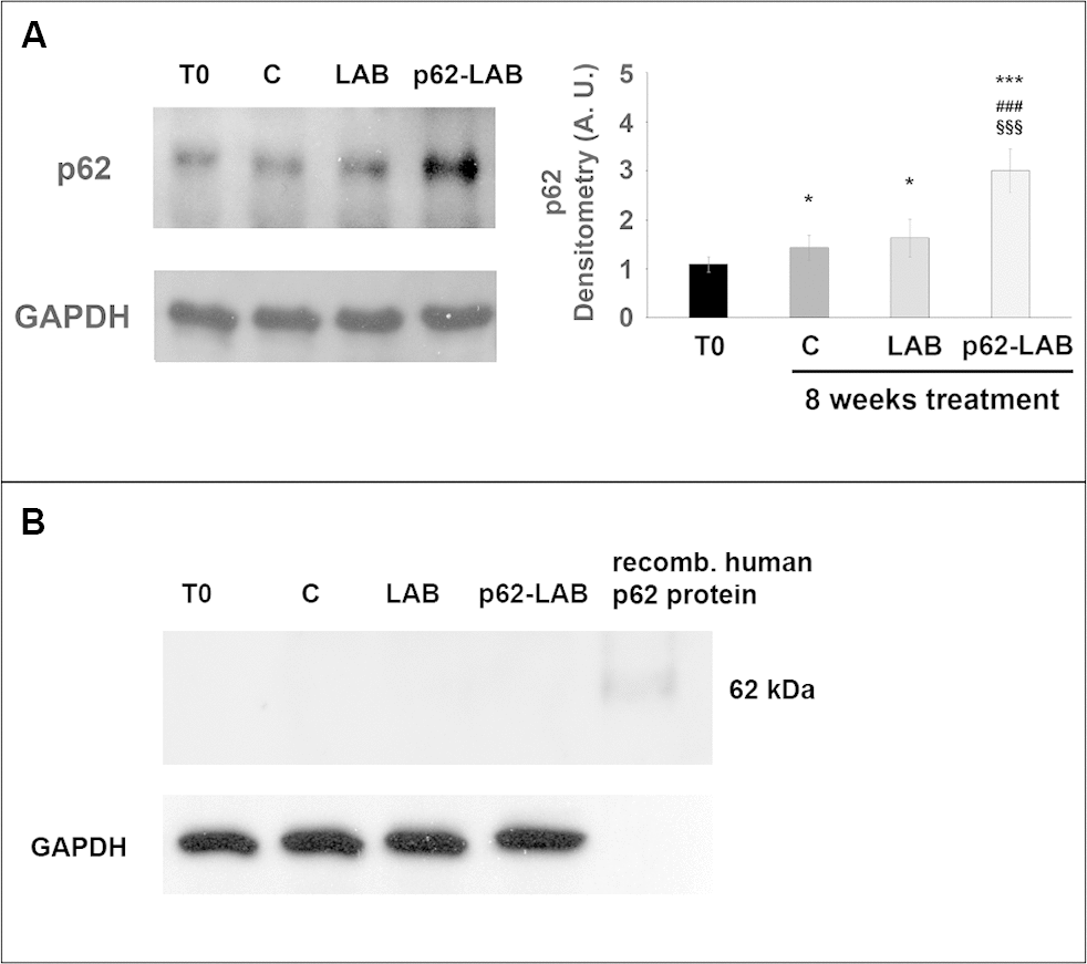 Immunodetection of the p62 protein in brain homogenates of T0, control and treated 3xTg-AD mice. Panel A shows detection of the m-p62 using a monoclonal anti-murine p62 antibody. GAPDH was used as a control to check equal protein loading. Densitometry is shown on the right (*p***p###p§§§pB shows detection of the h-p62 protein in brain homogenates of T0, control (C) and treated 3xTg-AD mice using a monoclonal anti-human p62 antibody. 3 μg of a recombinant human p62 protein were loaded as control. GAPDH was used as a control to check equal protein loading.