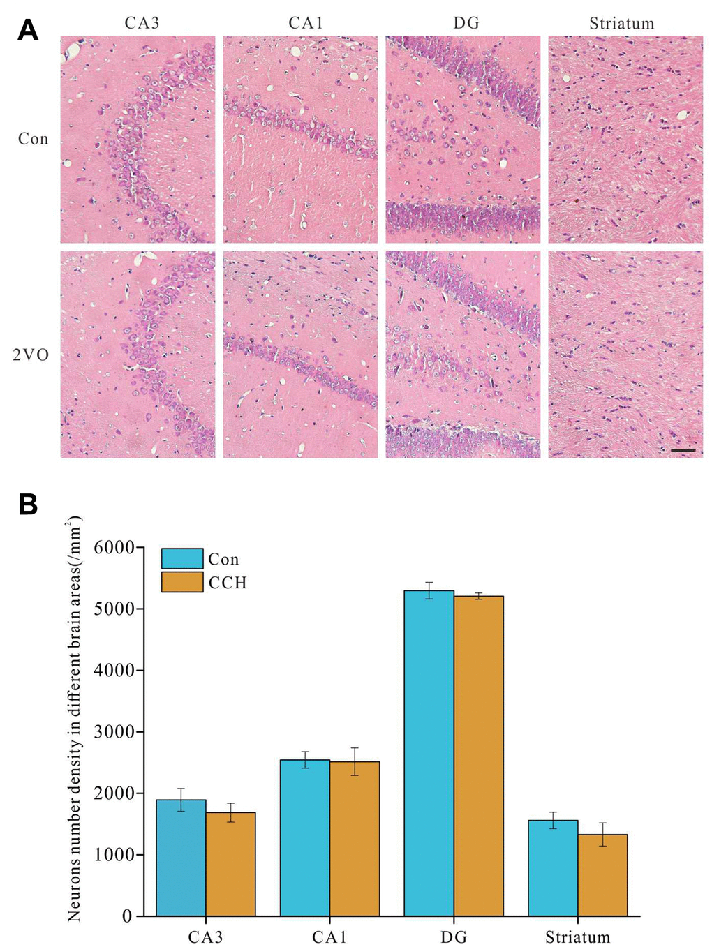 No obvious number changes of neurons in hippocampus and striatum after chronic cerebral hypoperfusion. The brain slides were stained with HE staining. (A) the images of CA1, CA3, DG of hippocampus and striatum, (B) the analysis of the number of neurons in hippocampus and striatum.