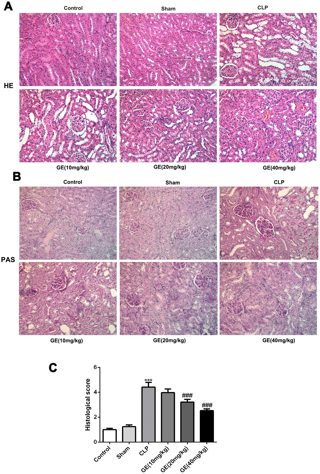 Effect of GE on sepsis-induced kidney injury. Sepsis-induced kidney injury model in BALB/c mice was conducted using cecal ligation and puncture (CLP) surgery, and the mice were received GE 1 h after the CLP surgery at different doses (10 mg/kg, 20 mg/kg and 40 mg/kg) three times (once every 6 h). 24 h after the surgery, H&E staining and PAS staining were performed to observe the histopathological changes (A, B). The histological injury was quantified (C). ***p