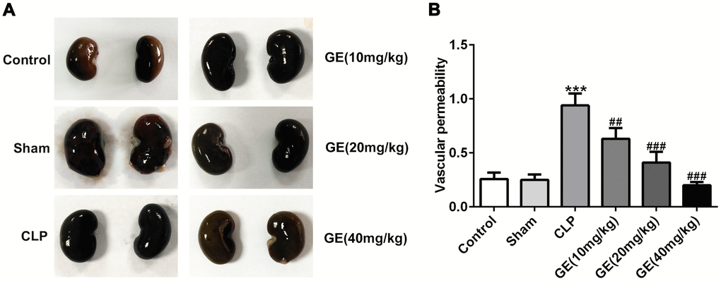 Effect of GE on sepsis-induced vascular permeability. Evans blue dye was injected intraperitoneally into the mice, and kidney tissues were collected and observed after 24 h (A). The amount of Evans blue dye in the supernatant of kidney tissue was analyzed by detecting absorbance at 620 nm (B). ***p