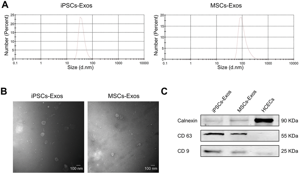 Characterization of iPSCs/MSCs-Exos. (A) NTA results demonstrate iPSCs/MSCs-Exos size distribution after isolation via ultracentrifugation. The diameter of iPSCs-Exos ranged from 30 to 120 nm while that of MSCs-Exos was between 60 and 400 nm. (B) TEM image of isolated exosomes showing a round morphology with diameters of approximately 100 nm. (C) Western blot illustrating the presence of the exosome markers CD9 and CD63, as well as the absence of the negative exosome markers Calnexin in isolated exosomes. HCEC cell lysate was used as a control.