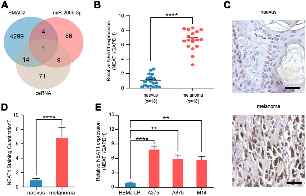 NEAT1 was upregulated in melanoma cells. (A) Venn diagram of intersection of target lncRNAs predicted by bioinformatics analysis. (B) RT-qPCR was performed to measure the level of NEAT1 in benign naevus (n=18) and melanoma tissues (n=18). (C) RNAscope detection of NEAT1 expression in melanoma tissues and benign naevus. Scale bars: 100 μm. (D) Quantitative analysis of NEAT1 expression in melanoma tissues (n=18) and benign naevus (n=18). (E) RT-qPCR was performed to measure the level of NEAT1 in various melanoma cells (A375, A875 and M14) and non-cancer cells, HEMa-LP.