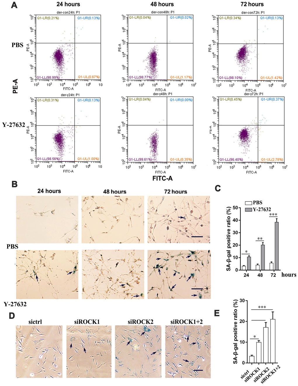 The inhibition of ROCK signaling promotes the cellular senescence of HDFs. (A) HDFs were treated with PBS or 10 μM Y-27632, then were collected at the indicated times, stained with annexin V-FITC combined with PI, then analyzed by FACS for apoptotic cells. (B) HDFs were treated with PBS (upper) or 10 μM Y-27632 (lower), then fixed at the indicated times and analyzed using a SA-β-gal staining kit for senescent cells. scale bar = 100 μm. (C) Quantification of (B), the percentage of SA-β-gal positive cells (blue, arrows) was calculated based on counting a total of 500 cells. (D) HDFs were transfected with siRNAs for ROCK1 and/or ROCK2, or with a scrambled siRNA as a control (sictrl), and at 48 h after transfection, cells were fixed and stained with SA-β-gal for senescent cells (blue, arrows), scale bar = 100 μm. (E) Quantification of SA-β-gal-positive cells in (D), the percentage of SA-β-gal-positive cells was calculated based on counting a total of 500 cells. All experiments were performed at least 3 times,*P