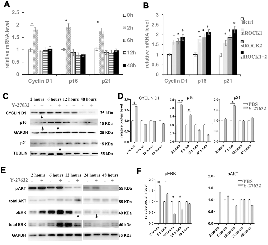 Inhibition of ROCK signaling increases the expression of proliferation and senescence markers. (A) HDFs were cultured in growth medium in the presence of PBS or 10 μM Y-27632, then were collected at the indicated times for RT-qPCR analysis of cyclin D1, p16 and p21. The expression level of those 3 genes was adjusted with the house-keeping gene 36B4, the mRNA level in the Y-27632 treated HDFs relative to the control HDFs (expression level as 1) is shown. (B) HDFs were transfected with siRNAs targeting ROCK1 or and ROCK2, the control HDFs were transfected with a scrambled siRNA (sictrl). HDFs were collected at 48 h after the transfection and subjected to RT-qPCR analysis to detect mRNA expression levels of cyclin D1, p16 and p21. The relative mRNA level of 3 genes in ROCK knockdown HDFs is shown. (C, D) HDFs were treated with PBS (-) or 10 μM Y-27632 (+), then were collected at the indicated times and cellular lysates were analyzed for protein expression levels of cyclin D1, p16 and p21 by western blot. GAPDH or β-tubulin protein levels were used as loading controls. Arrows inidcated increased expression of genes in the Y-27632 treated cells (C). The fold change of those proteins in the Y-27632 treated HDFs relative to the control HDFs (expression level as 1) is shown on the right (D). (E, F) Western blot analysis of pERK and pAKT in HDFs at the indicated times; GAPDH protein levels were detected as a loading control. The fold change of these 3 proteins in the Y-27632 treated HDFs relative to the control HDFs (expression level as 1) is shown on the right (F). Densitometry measurements for pERK and pAKT were normalized to the amounts of total ERK and AKT, respectively. Arrows inidcated decreased expression of phorylation form of ERK in the Y-27632 treated cells (E). All experiments were repeated at least 3 times, *P