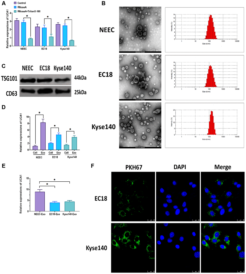 Exosomal UCA1 participated in intercellular communication. (A) Expression of UCA1 in the medium of NEEC, EC18, and Kyse140 cells treated with RNase (2 ug/ml) or the combination of RNase (2 ug/ml) and Triton X-100 (0.1%). (B) Morphology and size of exosomes derived from the medium of NEEC, EC18, and Kyse140 cells, respectively. Scale bar = 100 nm. (C) Protein expressions of exosomal markers TSG101 and CD63 in exosomes derived from the medium of NEEC, EC18, and Kyse140 cells, respectively. (D) Relative expressions of UCA1 in exosomes and exosome-releasing cells. (E) Relative expressions of UCA1 in exosomes derived from NEEC, EC18, and Kyse140 cells. (F) Exosomes derived from NEEC cells were taken up by EC18, and Kyse140 cells. Exosomes were labeled with PKH67 (green), and the nuclei were labeled with DAPI (blue). Scale bar = 25 nm. (*) denotes the difference between groups (P