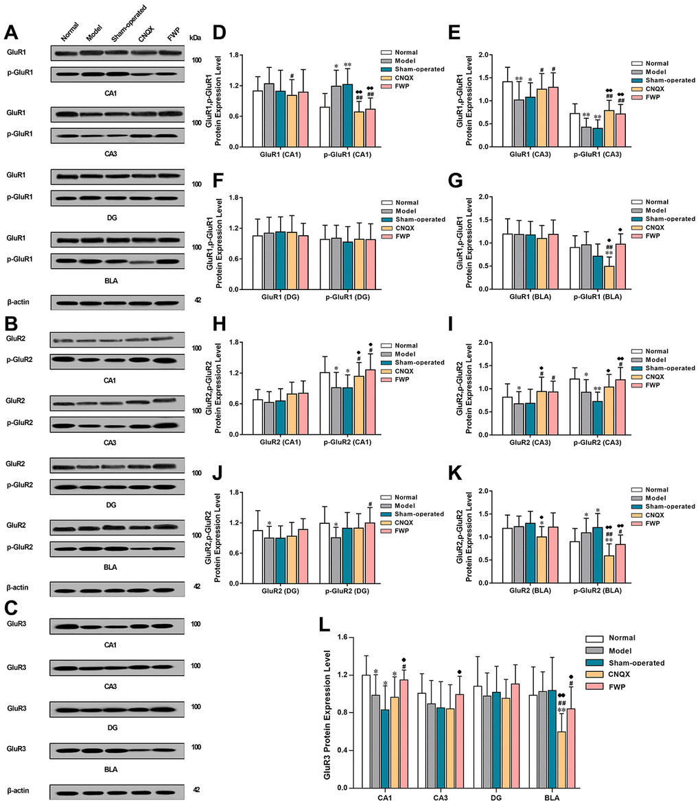 Effects of FWP on protein expression and phosphorylation of GluR1, GluR2 and GluR3 in hippocampus and amygdala, in chronic restraint stress induced rat model representing depression with liver-depression and spleen-deficiency syndrome. (A, D–G) protein expression and phosphorylation of GluR1. (B, H–K) protein expression and phosphorylation of GluR2 expression. (C, L) GluR3 expression (n=8). *PP#P##P♦P♦♦P