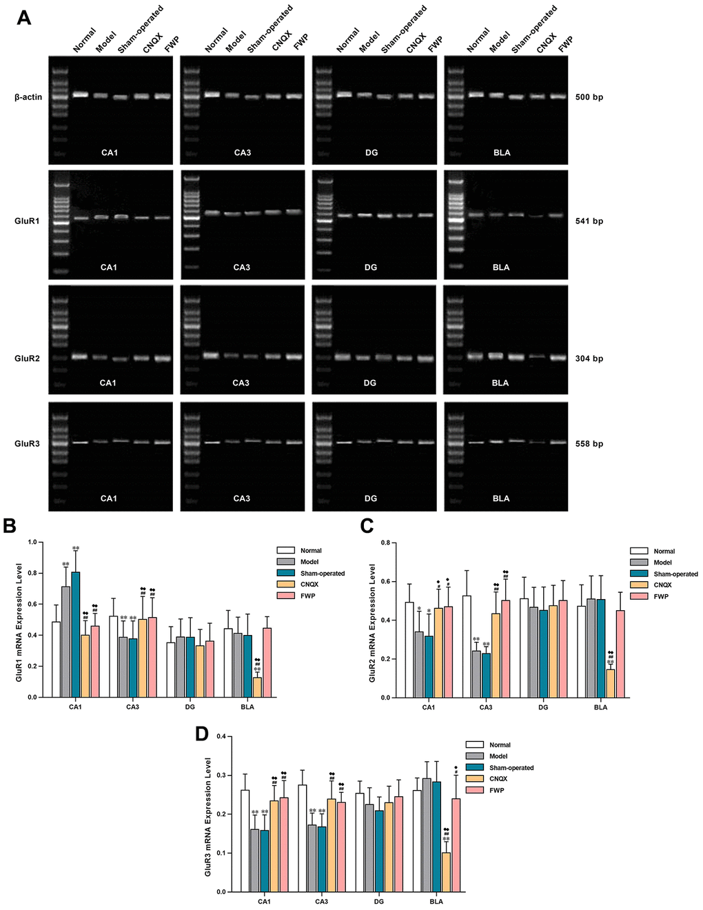 Effects of FWP on gene expression of GluR1, GluR2 and GluR3 in hippocampus and amygdala, in chronic restraint stress induced rat model representing depression with liver-depression and spleen-deficiency syndrome. (A) Electrophoresis of GluR1, GluR2 and GluR3. (B–D) relative quantitation of GluR1, GluR2, and GluR3 (n=5). *PP#P##P♦P♦♦P