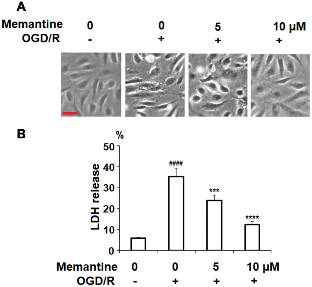 Memantine protected oxygen-glucose deprivation/reperfusion (OGD/R)-induced cell death in HUVECs. Cells were treated with memantine (5, 10 μM) for 6 h, followed by exposure to oxygen-glucose deprivation (6 h)/reperfusion (24 h) (OGD/R). (A) Cell morphology of HUVECs; Scale bar, 100 μm; (B) LDH release (####, P