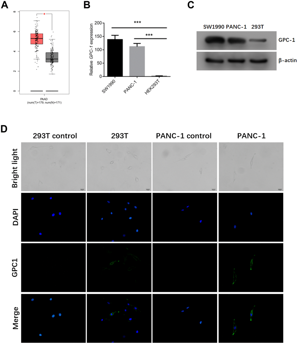 Expression of GPC1 in 293T cells, sw1990 cells and PANC-1 cells. (A) GPC1 expression in pancreatic cancer was predicted by GEPIA. The mRNA and protein levels of GPC1 in 293T cells, SW1990 and PANC-1 cells by (B) qRT-PCR and (C) western blotting. (D) The expression of GPC1 in 293T cells and PANC-1 cells by cell immunofluorescence. bar = 20 μm. *p