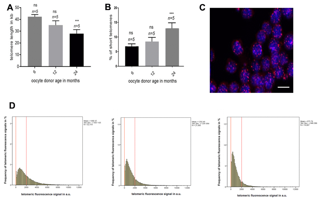 Telomere length in oocyte donor leukocytes. (A) Graph represents the quantification of the mean telomere length in the 6, 12 and 24 months old donors group by HT-Q-FISH (mean values ±s.e.m., n=number of blood samples in each group). (B) Graph showing the percentage of short telomeres in the same settings. Short telomeres are considered those in the 10% percentile of the total telomere length distribution (mean values ± s.e.m., n=technical replicates). (C) Representative confocal microscopy picture of oocyte donor leukocytes (blue=DAPI, red=telomeres, scale bar = 5um). (D) Representative frequency graphs of telomere length distribution in arbitrary units (a.u.) of intensity measured in the 6, 12 and 24 (from left to right) months old oocyte donors and the mean telomere length and the number of telomeres analyzed is shown. The red lines are arbitrary lines placed in the exact same position in each frequency graph to visualize differences between samples, the y-axis represents the frequency in percentage of telomere length distribution and the x-axis shows the telomeric fluorescence signal in a.u. . One-way ANOVA with Dunnett’s post test was used for the statistical analysis (*p