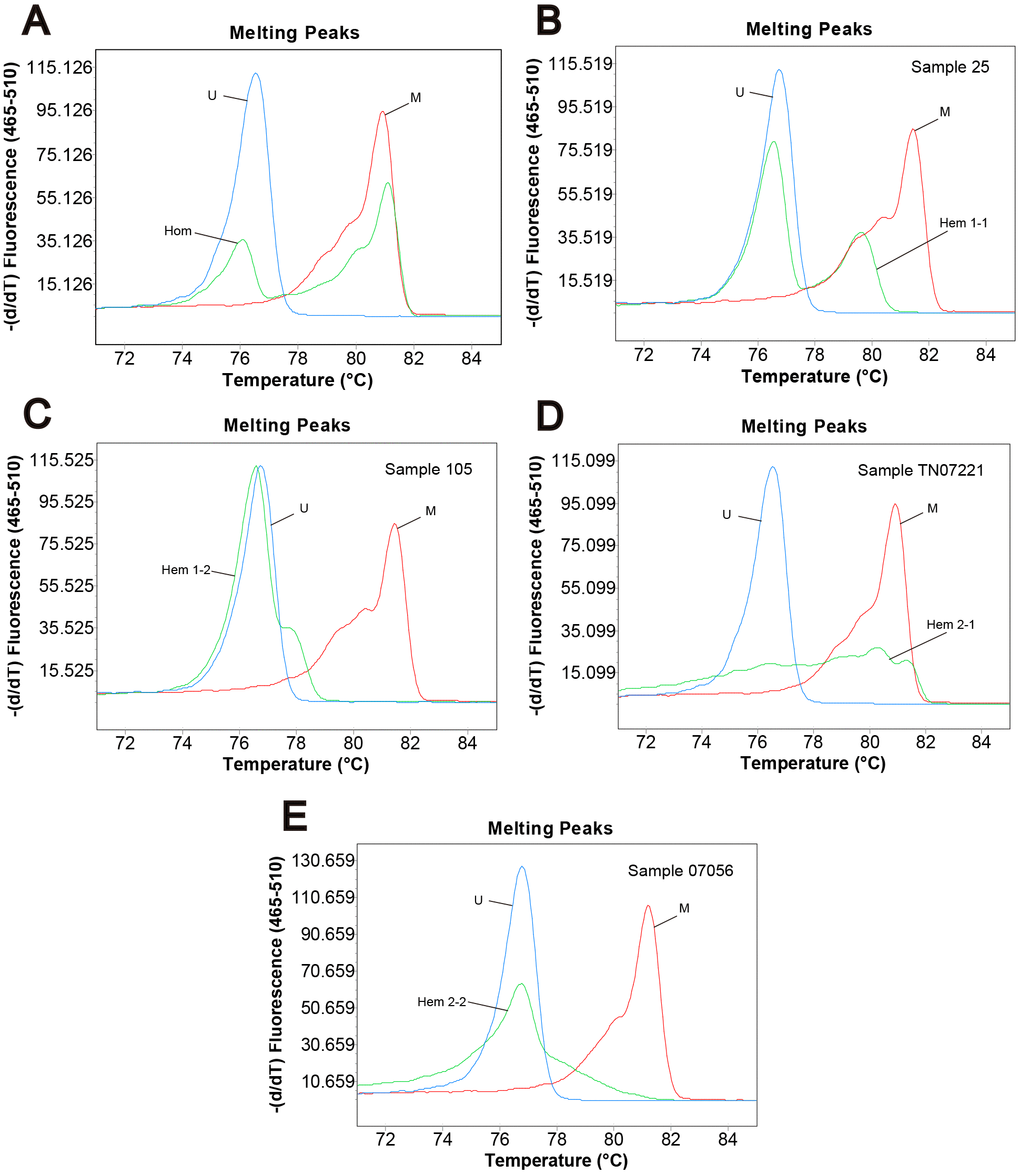 Methylation status of CRC samples defined by melting peak. Melting profiles of the methylation control (M), unmethylation control (U), and (A) the sample with homogeneous methylation (Hom); (B) sample 25 with heterogeneous methylation 1-1 (Hem 1-1); (C) sample 105 with heterogeneous methylation 1-2 (Hem 1-2); (D) sample TN07221 with heterogeneous methylation 2-1 (Hem 2-1); (E) sample 07056 with heterogeneous methylation 2-2 (Hem 2-2).