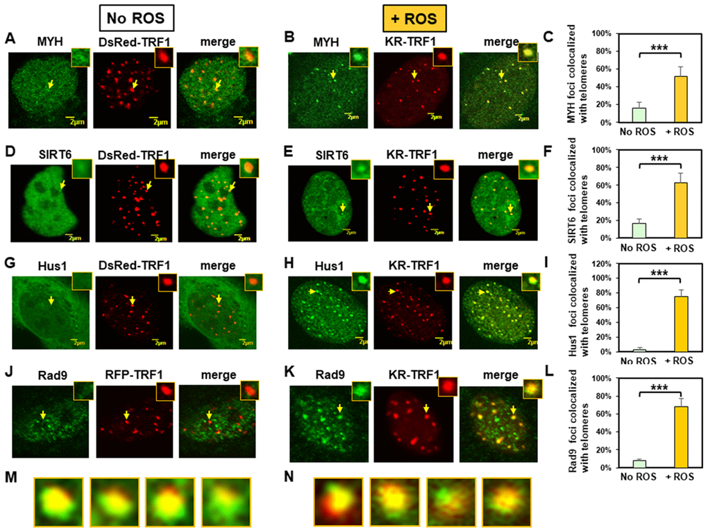 Expressed MYH, SIRT6, Hus1, and Rad9 are recruited to oxidatively damaged telomeric sites in mouse embryonic fibroblast (MEF) cells. (A), (D), (G), and (J), Distribution of GFP-hMYH, GFP-hSIRT6, GFP-hHus1, and FLAG-Rad9, respectively, in undamaged MEF cells containing DsRed-TRF1 or RFP-TRF1. Some GFP-hMYH and GFP-hSIRT6 granules are localized to DsRed-TRF1 at telomeres as shown in enlarged merged images. (B), (E), (H), and (K), GFP-hMYH, GFP-hSIRT6, GFP-hHus1, and FLAG-Rad9, respectively, form foci at KR-TRF1 damaged telomeric sites after light activation. Images were captured 30 min after light activation with an Olympus FV1000 confocal microscopy system. (C), (F), (I), and (L), Quantitative analyses of 20 cells in each undamaged and KR-induced damaged group. About 15% of granulated GFP-MYH and GFP-SIRT6 spots were localized to DsRed-TRF1 at telomeres (C, F). Over 50% of GFP-MYH, GFP-SIRT6, or GFP-Hus1 foci are colocalized with KR-TRF1 after KR activation. Error bars indicate SD; n ≥ 20. The P-value is calculated by Student’s t-test using Stat Plus software; P  0.01 is shown as ***. (M), Enlarged merged images from (H) showing segregation of green GFP-hHus1 and red KR-TRF1 foci. (N), Enlarged merged images from (K) showing segregation of green FLAG-hRad9 and red KR-TRF1 foci.
